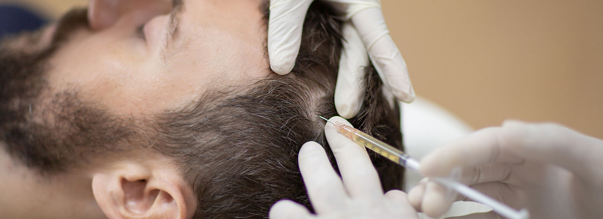Platelet Rich Plasma (PRP)